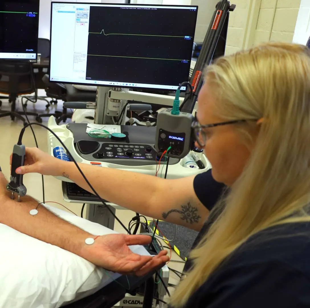 view of nerve conduction being done on a forearm of subject